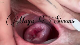 Small cervix without dilating